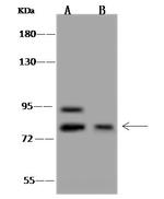 FOXM1 Antibody in Western Blot (WB)