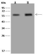 G6PD Antibody in Western Blot (WB)