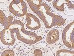 GART Antibody in Immunohistochemistry (Paraffin) (IHC (P))