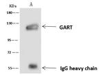 GART Antibody in Immunoprecipitation (IP)