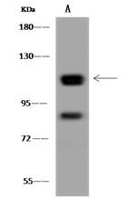 GART Antibody in Western Blot (WB)