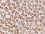 GPT2 Antibody in Immunohistochemistry (Paraffin) (IHC (P))