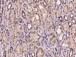 HADHB Antibody in Immunohistochemistry (Paraffin) (IHC (P))