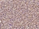 HADHB Antibody in Immunohistochemistry (Paraffin) (IHC (P))