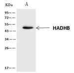 HADHB Antibody in Immunoprecipitation (IP)