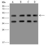 HADHB Antibody in Western Blot (WB)