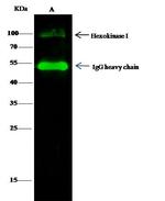 HK1 Antibody in Immunoprecipitation (IP)