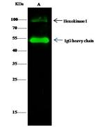 HK1 Antibody in Immunoprecipitation (IP)