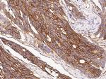 IFITM1 Antibody in Immunohistochemistry (Paraffin) (IHC (P))