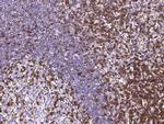 IFITM1 Antibody in Immunohistochemistry (Paraffin) (IHC (P))