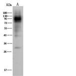 IFNGR1 Antibody in Western Blot (WB)