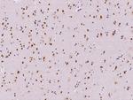 SAM68 Antibody in Immunohistochemistry (Paraffin) (IHC (P))