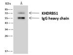 SAM68 Antibody in Immunoprecipitation (IP)