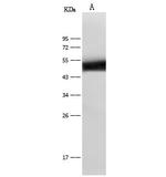 KRT14 Antibody in Western Blot (WB)