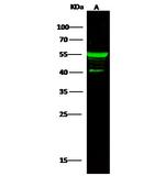 Cytokeratin 5 Antibody in Western Blot (WB)