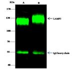 LAMP2 Antibody in Immunoprecipitation (IP)