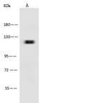 Leptin Receptor Antibody in Western Blot (WB)