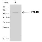 LTA4H Antibody in Immunoprecipitation (IP)