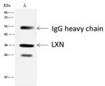 Latexin Antibody in Immunoprecipitation (IP)