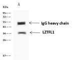 LZTFL1 Antibody in Immunoprecipitation (IP)