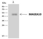 MAGEA10 Antibody in Immunoprecipitation (IP)