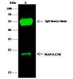 LC3B Antibody in Immunoprecipitation (IP)