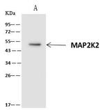 MEK2 Antibody in Immunoprecipitation (IP)