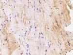 MEK3 Antibody in Immunohistochemistry (Paraffin) (IHC (P))