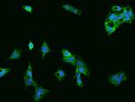 MFN2 Antibody in Immunocytochemistry (ICC/IF)
