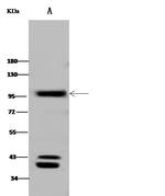 CD10 Antibody in Western Blot (WB)