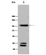 CD10 Antibody in Western Blot (WB)