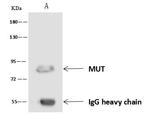 MUT Antibody in Immunoprecipitation (IP)