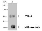 MSH2 Antibody in Immunoprecipitation (IP)