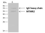 MTMR2 Antibody in Immunoprecipitation (IP)