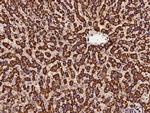 NDUFS1 Antibody in Immunohistochemistry (Paraffin) (IHC (P))