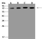 NDUFS1 Antibody in Western Blot (WB)