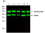 IkB alpha Antibody in Immunoprecipitation (IP)