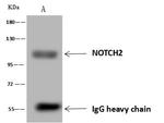 NOTCH2 Antibody in Immunoprecipitation (IP)
