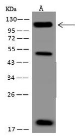 NOTCH2 Antibody in Western Blot (WB)