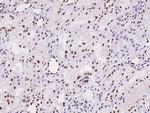 NPM1 Antibody in Immunohistochemistry (Paraffin) (IHC (P))