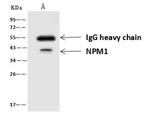 NPM1 Antibody in Immunoprecipitation (IP)