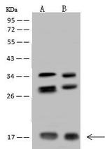 NUDT11 Antibody in Western Blot (WB)