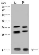 NUDT11 Antibody in Western Blot (WB)