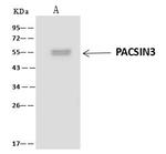 PACSIN3 Antibody in Immunoprecipitation (IP)