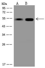 PACSIN3 Antibody in Western Blot (WB)