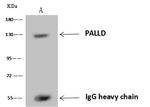 Palladin Antibody in Immunoprecipitation (IP)