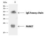 PARK7 Antibody in Immunoprecipitation (IP)