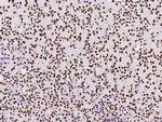 PAX2 Antibody in Immunohistochemistry (Paraffin) (IHC (P))