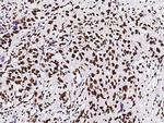 PAX2 Antibody in Immunohistochemistry (Paraffin) (IHC (P))