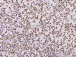 PAX2 Antibody in Immunohistochemistry (Paraffin) (IHC (P))